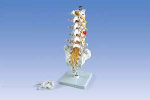  Flexible Lumbar Vertebral Column With Herniated Disc